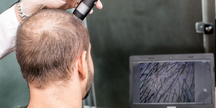 You are currently viewing Exame de Tricoscopia: saiba como funciona